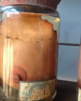 Breast in formaldehyde 1